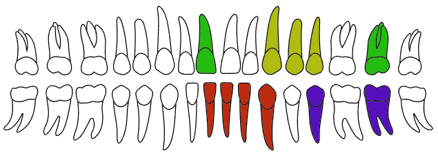 4Dental Clinic interactive tooth chart with selected treatments